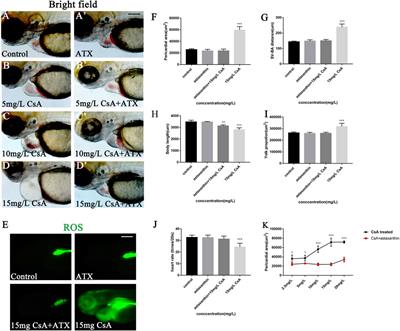 Cyclosporine A Induces Cardiac Developmental Toxicity in Zebrafish by Up-Regulation of Wnt Signaling and Oxidative Stress